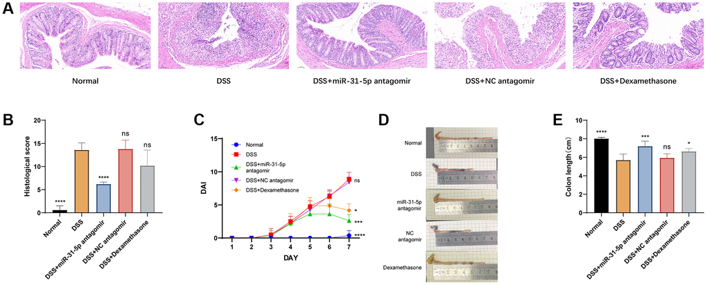 miR-31-5p antagomir contributed to the damage of DSS to colon in mice. (A) Analysis of hematoxylin and eosin (HE) from colonic samples (x200 magnification). (B) DAI scores. (C) Colon lengths were presented. (D) Statistics of colon length. (E) Histological scores based on HE staining method. Each bar represents mean ± SD, n ≥ 3 from each group. ns represented P > 0.05, *P **P ***P ****P 