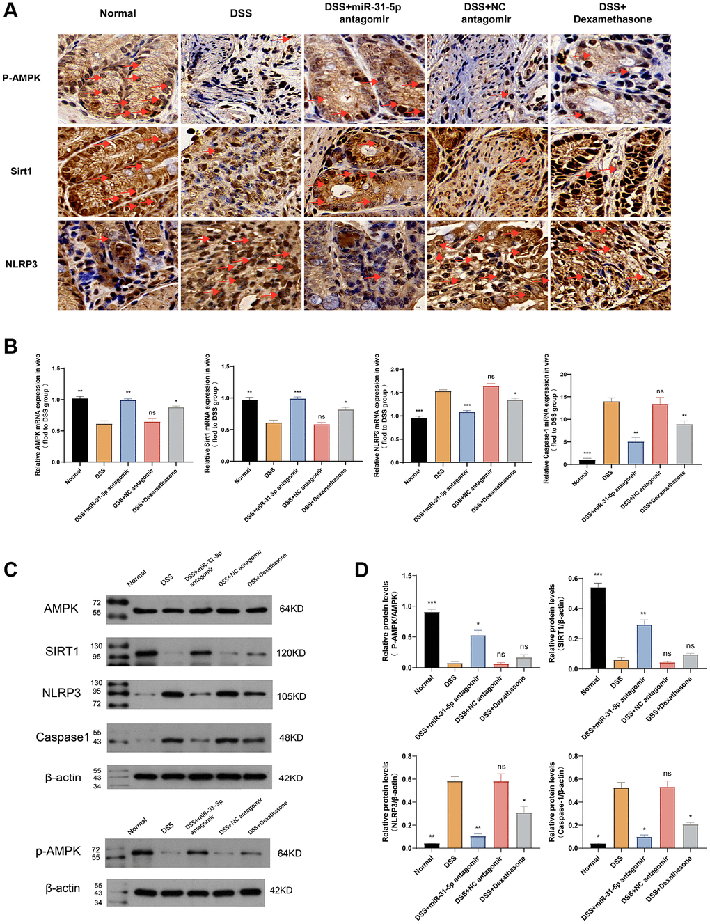 mir-31-5p may target AMPK/Sirt1/NLRP3 axis to mediate DSS-induced colonic mucosal inflammation in mice. (A) Immunohistochemical analysis of P-AMPK, Sirt1 and NLRP3 in colon of mice. Yellow brown were positive signals (the ruler was 10 um, and the positive signals were marked by red arrows). (B) The relative mRNA levels of AMPK, Sirt1, NLRP3 and caspase-1 in colon tissues of mice were detected by qPCR. (C) Western blot analysis of P-AMPK/AMPK, NLRP3, Sirt1 and caspase-1. (D) Quantitative protein analysis of P-AMPK/AMPK, Sirt1, NLRP3 and caspase-1. Each bar represents mean ± SD, n ≥ 5 from each group. Ns represented P > 0.05, *P **P ***P 
