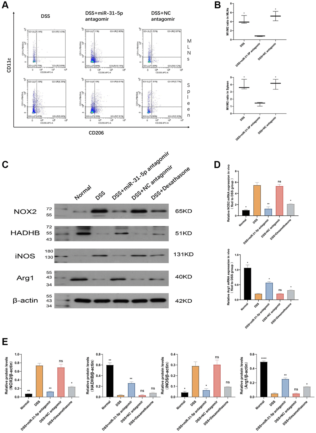 mir-31-5p antagomir may alleviate colitis in mice by transforming M1-type macrophages into M2-type macrophages. (A) The ratio of M1/M2 in spleen and lymphocytes was determined by flow cytometry. (B) Statistical analysis of M1/M2 ratio in spleen and lymphocytes. (C) The expressions of NOX2, HADHB, iNOS, Arg1 and β-catenin proteins in colon were analyzed by Western blotting. (D) The mRNA expression of M1-type and M2-type macrophage marker genes was detected by qPCR. (E) Statistical analysis of protein expression levels of NOX2/β-actin, HADHB/β-actin, iNOS2/β-actin and Arg1/β-actin. Each bar represents mean ± SD, n ≥ 5 from each group. Ns represented P > 0.05, *P **P ***P ****P 