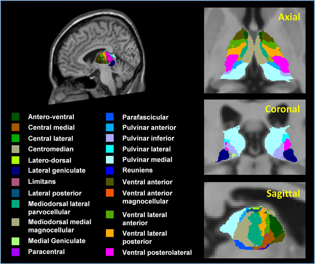 3D atlas of the thalamus and its subnuclei segmentation. Segmentation of thalamic subnuclei was performed using a built-in module of FreeSurfer.