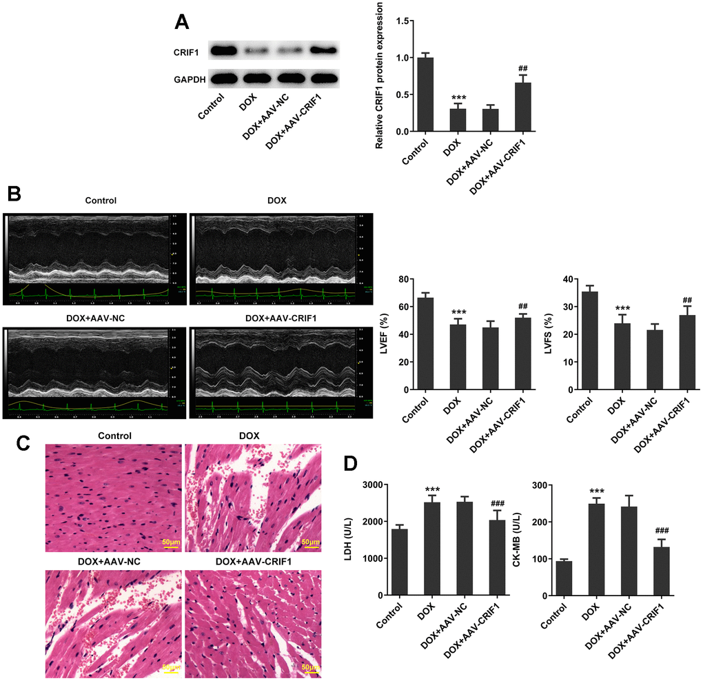 CRIF1 overexpression improved DOX-induced myocardial pathological injury. (A) AAV-CRIF1 or AAV-NC were delivered into mice prior to DOX administration, and the expression of CRIF1 was detected by western blot. (B) Quantitative analysis of cardiac function by echocardiography. (C) The pathological changes of myocardium were detected by H&E staining. (D) The expressions of LDH and CK-MB in serum were detected by biochemical kits. ***P