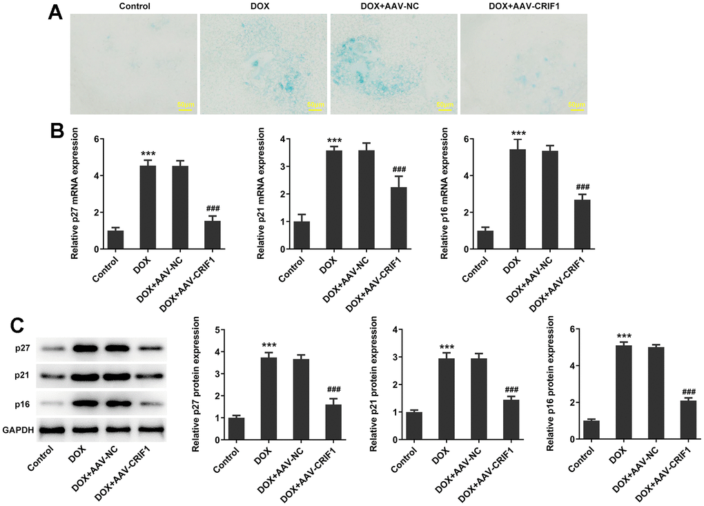 CRIF1 overexpression inhibited DOX-induced myocardial senescence. (A) The SA-β-gal assay was used to detect myocardial senescence. (B, C) RT-qPCR and western blot detected the expression of p27, p21, and p16. ***P
