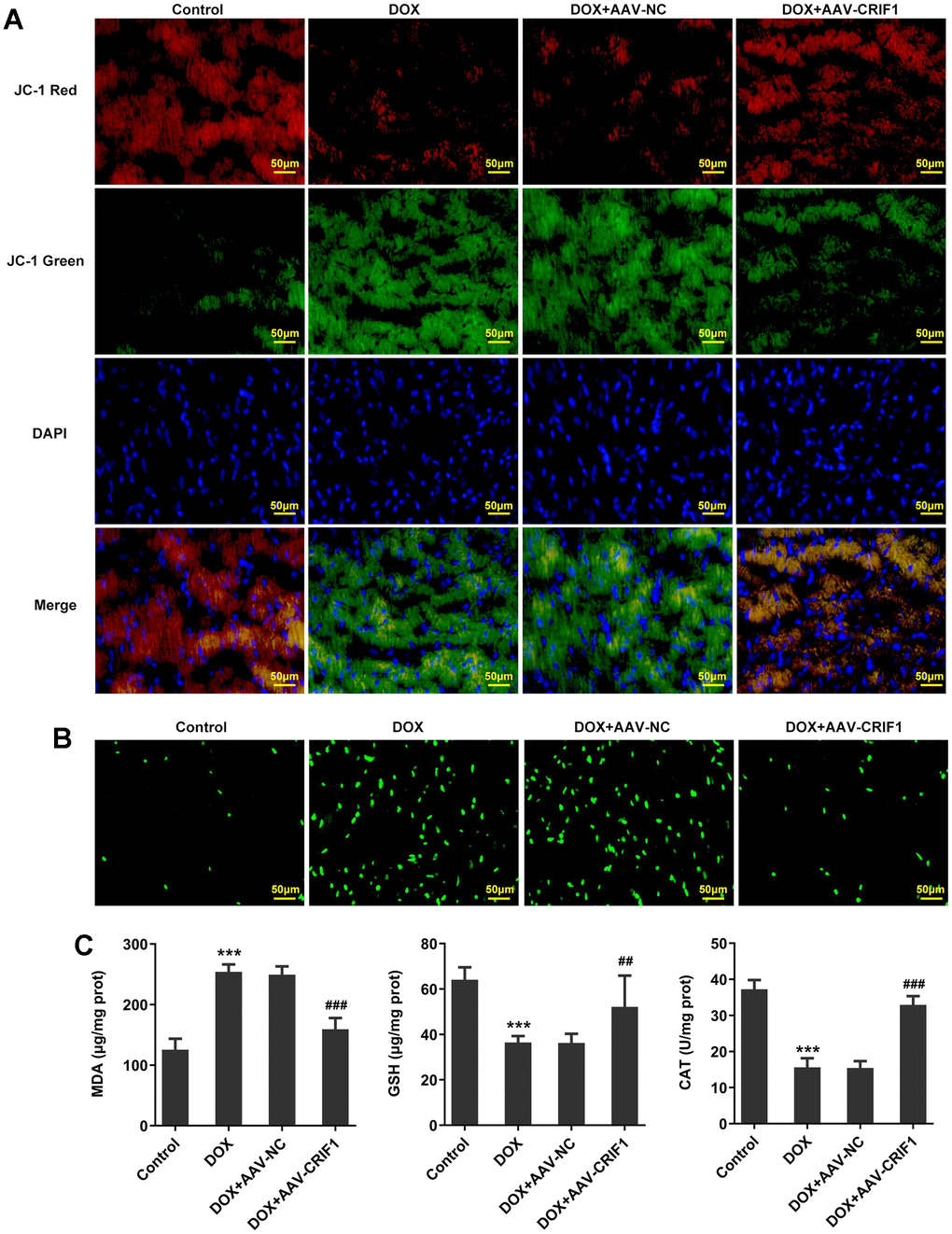 CRIF1 overexpression alleviated DOX-induced myocardial mitochondrial dysfunction. (A) The changes of MMP were detected by JC-1 staining. (B) DCFH-DA staining was used to detect ROS levels. (C) The levels of MDA, GSH and CAT in myocardial tissues were detected by biochemical kits. ***P