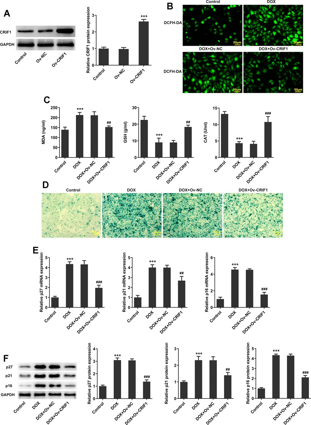CRIF1 overexpression inhibited oxidative stress and senescence in DOX-induced AC16 cells. (A) AC16 cells were transfected with Ov-NC or Ov-CRIF1, and the overexpression efficacy of CRIF1 was detected by western blot. ***PB) DCFH-DA staining was used to detect ROS levels. (C) The expression levels of MDA, GSH and CAT in cells were detected by biochemical kits. (D) SA-β-gal staining was used to observe the level of cell senescence. (E, F) RT-qPCR and western blot were used to detect the expression of p27, p21, and p16. ***P