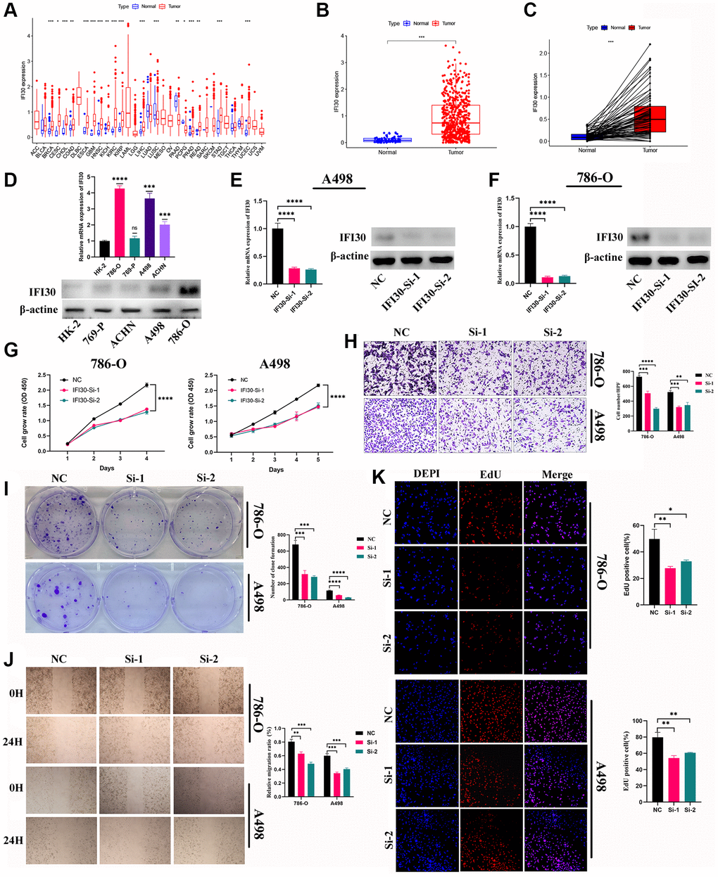 The role of IFI30 in KIRC. (A) Pan-cancer analysis of IFI30 expression in human tumors. (B) Expression of IFI30 in KIRC and para-cancerous tissues in TCGA database. (C) Expression of IFI30 in KIRC and normal tissues in TCGA database. (D) IFI30 was highly expressed in KIRC cell lines compared to normal renal tubular epithelial cell line (HK-2). (E, F) RT-qPCR and Western blot were used to verify the interference efficiency of IFI30 in A498 and 786-O cells. (G) CCK8 assay. (H) Transwell assay. (I) Colony formation assay. (J) Wound healing assay. (K) EdU staining assay. Error bars are mean ± SD, *P **P ***P 