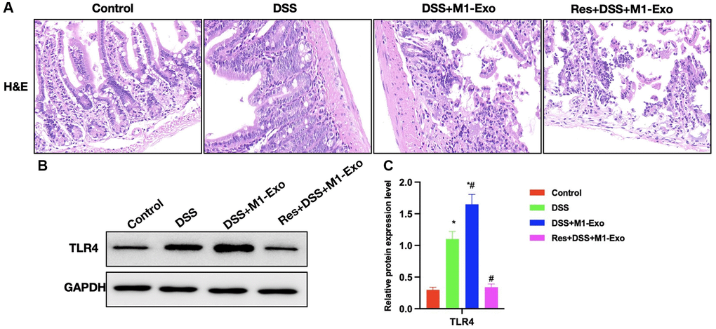 Suppressing TLR4 signal antagonizes the effect of M1-Exo on tissue pathology. (A) H&E (n = 5). Res improved mouse intestinal inflammation and epithelial cell injury, and decreased the inflammatory response in intestinal tissue. (B, C) Relative protein levels (n = 5). Res reduced TLR4 expression. *P #P 