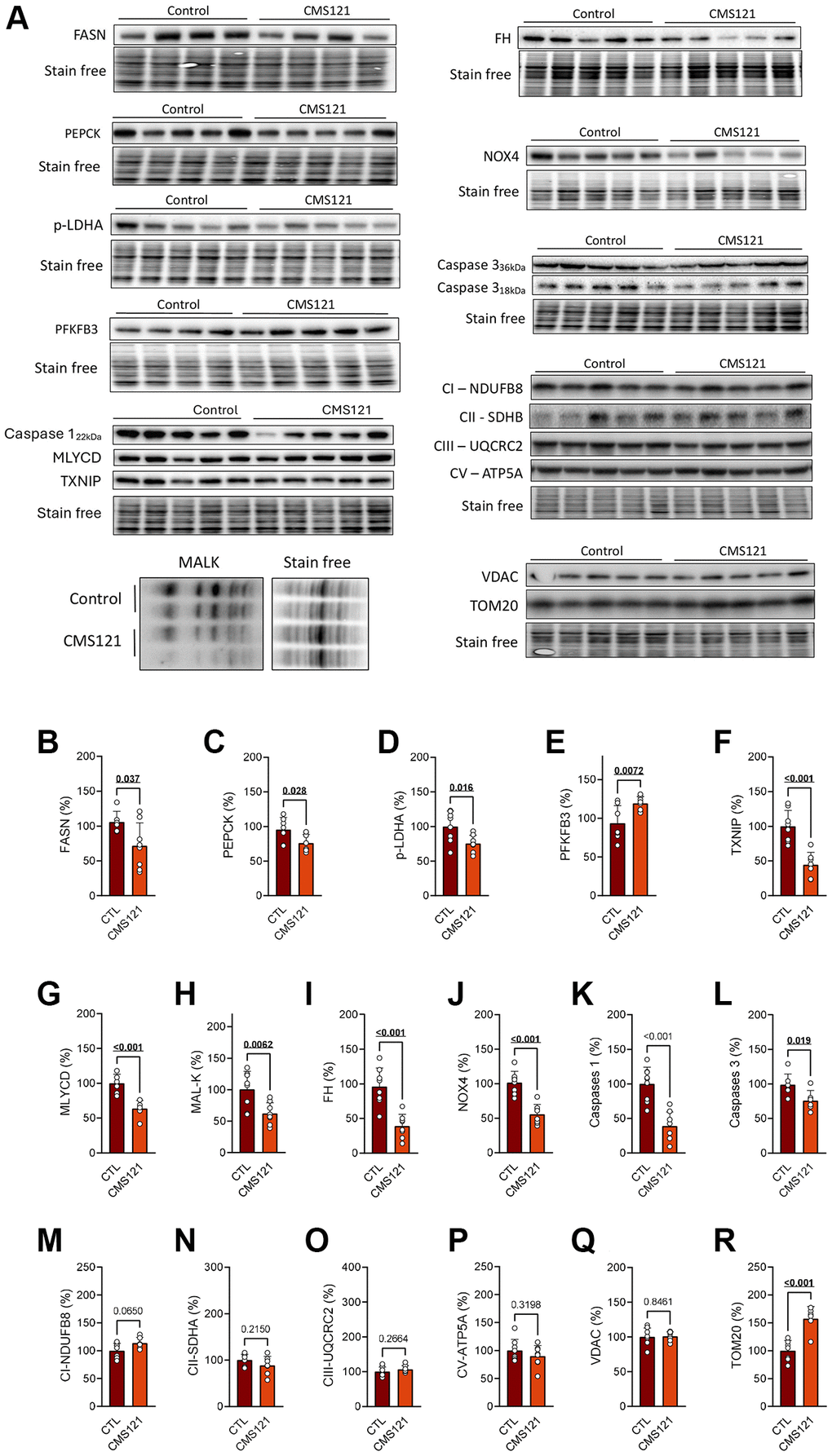 Liver protein markers were evaluated in mice fed with CMS121 for 6 months. Representative blot images (A), and the corresponding quantification (B–R) of metabolism markers in the hepatic tissue: FASN (B), PEPCK (C), p-LDH-A (D), PFKFB3 (E), TXNIP (F), MLYCD (G), malonylation of proteins at lysine residues (MAL-K, (H)), FH (I), Nox4 (J), caspase 1 (K), caspase 3 (L), and markers of mitochondrial complex I ((M); NDUFB8), complex II ((N); SDHB), complex III ((O); UQCRC2), and complex V ((P); ATP5A), as well as the voltage dependent anion channel VDAC (Q), and the outer membrane translocase TOM20 (R). Liver cytosolic fractions were used for blotting, except for the mitochondrial markers (M–R), FH (I), and NOX4 (J) that used mitochondrial fractions. Data are presented as mean ± SD (N = 6–8). Bold underlined p-values indicate statistical differences.