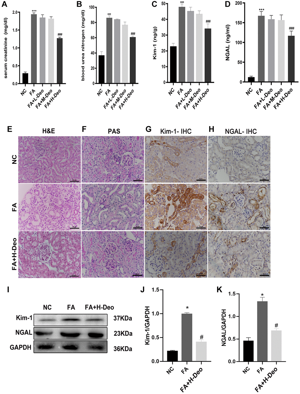 2’-deoxyadenosine administration attenuated the development of FA-induced AKI in mice. (A, B) Renal function of all mice was assessed by SCr and BUN. (C, D) Kim-1 and NGAL results of the mice were measured by ELISA. (E, F) Representative H&E and PAS of renal tissues obtained from specimens in different group. (G, H) Expression of Kim-1 and NGAL was determined by IHC. (I–K) Protein levels of NGAL and Kim-1 protein expression in the kidney were evaluated by western blot analysis. *P indicates a significant difference between the NC group and the FA group. #P represents the difference between the FA+Deo group and the FA group. P 