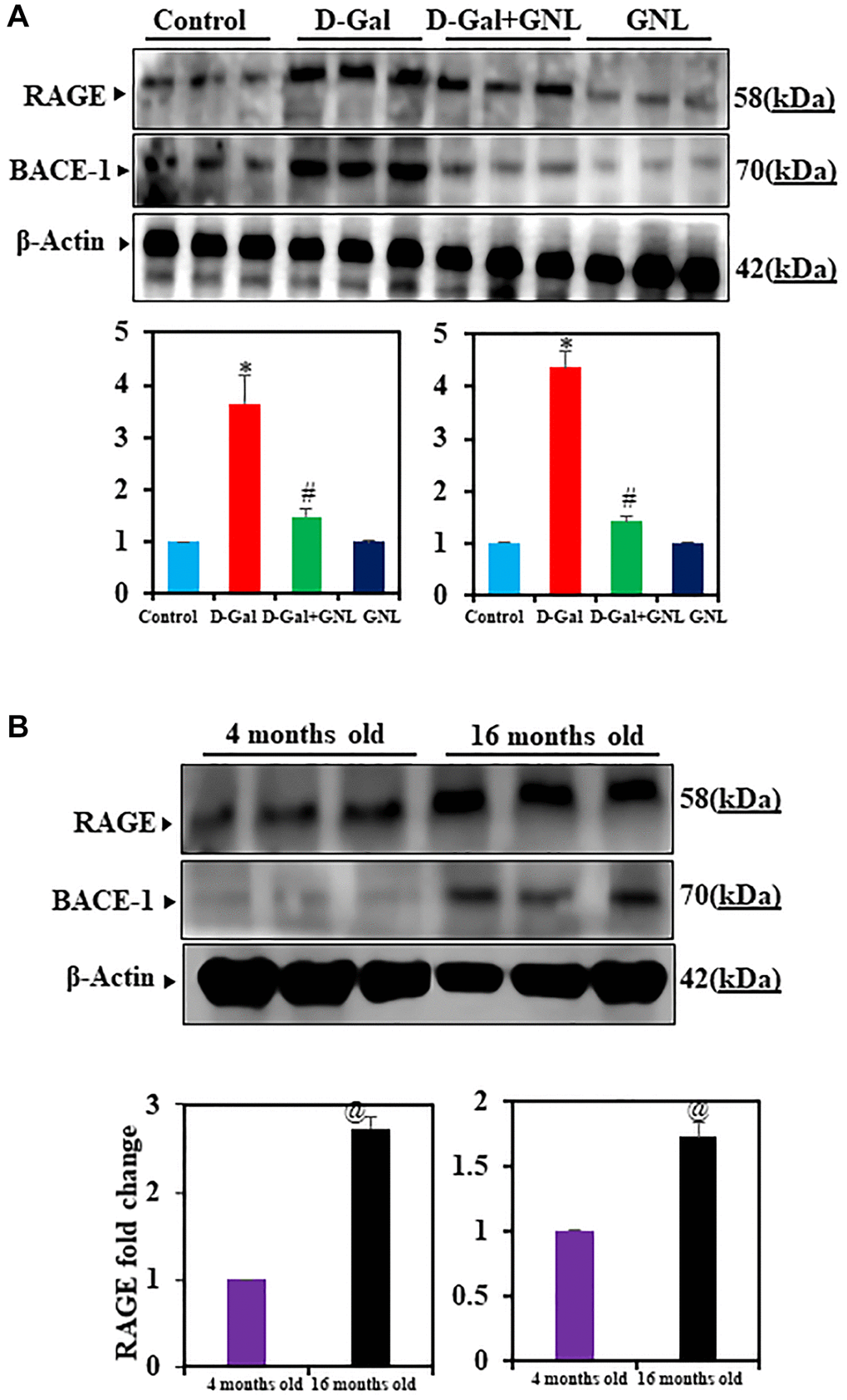 Effect of GNL on D-gal-induced cognitive impairment mice of RAGE and BACE-1 proteins in the hippocampus. (A) A Western blot analysis of the RAGE and BACE-1 protein levels. Three independent experiments are shown here. SDS-PAGE resolved the protein from each sample, and Western blots were done. The internal load controllers were β-actin. Densitometry analysis calculated changes in protein bands as 1.0-fold, as shown below the gel. (B) 4-month-old young control and 16-month-old mouse hippocampus tissue were analyzed for RAGE and BACE-1. The internal load controllers were β-actin. Densitometry analysis calculated changes in protein bands as 1.0-fold. Group I: Control; Group II: D-gal alone (150 mg/wt); Group III: D-gal (150 mg/wt) with GNL (40 mg/wt); and Group IV: GNL alone (40 mg/wt). Group V: 4-month-old young animals; Group VI: 16-month-old Values are expressed as the mean ± SD (n = 6). *P #P @P 