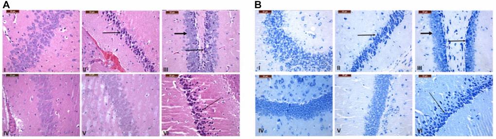 Histopathological alteration in the brain tissue of the control and treated groups. Hippocampus of regions stained with H&E (A) and Toluidine blue stain (B) (bar = 100 and 50 mm). Group I (6 weeks), the control group, showed a normal appearance and a high density of neurons with a light normal nuclear stain. Compared to the control group, Group II (6 weeks), which was made up of neurons that had dark nuclear staining (arrows) and focal disappearance, there was less density and necrosis in the D-gal group, which showed shrinking neurons with focal disappearance. In Group III (6 weeks), treatment with GNL revealed a protective effect, which showed mild neurodegeneration (thin arrows) with highly pronounced normal neurons (thick arrows). Normal appearance of neurons shown in Group IV (6 weeks) Treatment only. In Group V (4 months), a mild decrease in neuronal density has been shown compared to the control. However, severe neural loss, degeneration, and necrosis (arrows) were seen in old mice in Group VI (16 months) magnification 40X.