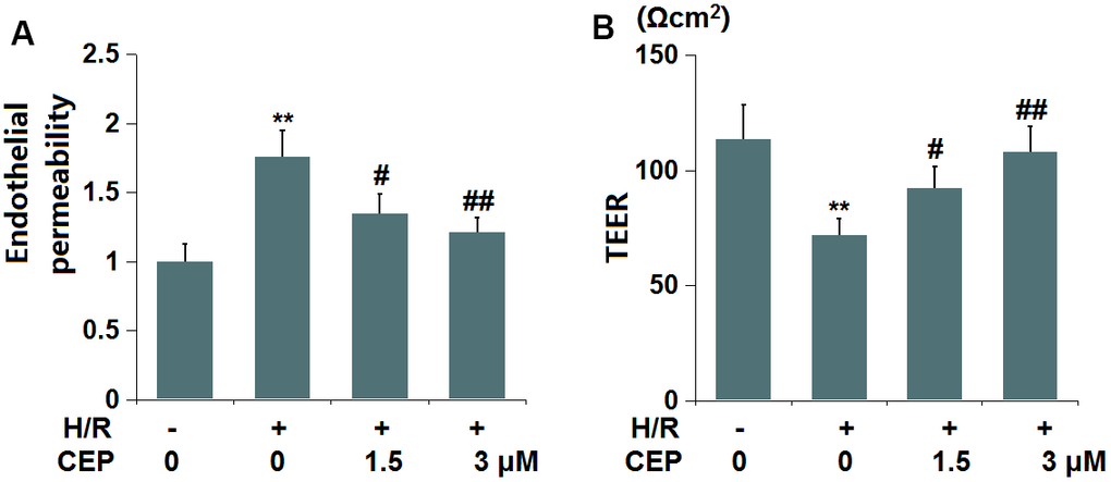 Cepharanthine (CEP) attenuated hypoxia/reperfusion-induced aggravation of endothelial permeability in brain bEND.3 endothelial cells. (A) Endothelial permeability was measured using FITC-dextran; (B) The trans-endothelial electrical resistance (TEER) (**, P