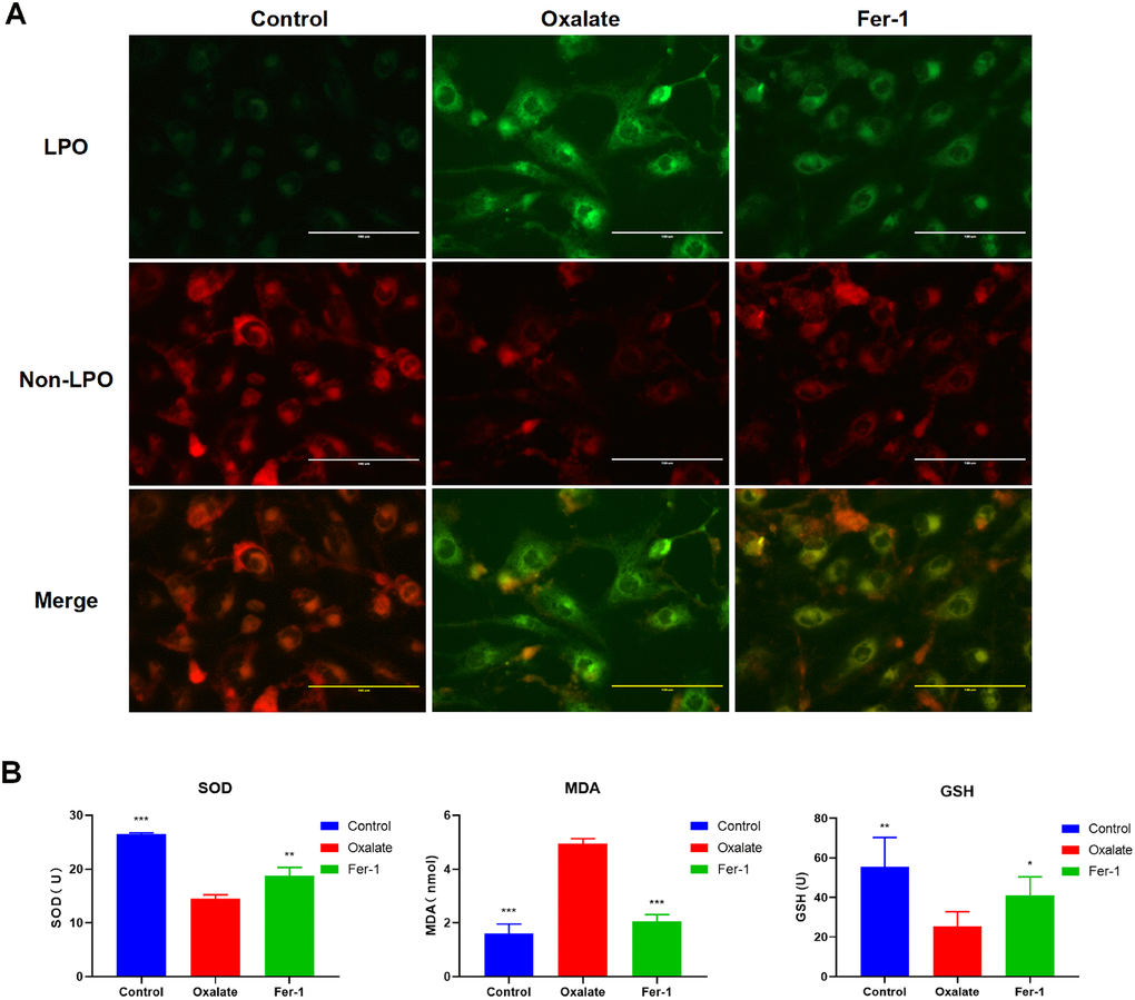 Fer-1 suppresses oxalate-induced cytotoxicity and LPO in HK-2 cells. (A) Measuring cellular LPO with the C11 BODIPY 581/591 fluorescent probe in HK-2 cells with different treatment (magnification×40; scale bar, 100 μm). (B) SOD, MDA, and GSH activity are detected in HK-2 cells with different treatment (mean ± SD, n = 3, *P P P 