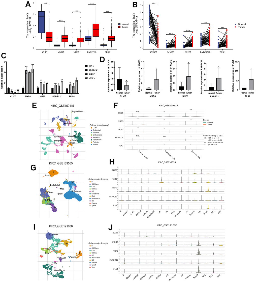 Expression validation of key genes in risk signatures of LLPS-related genes and single-cell analysis. (A) Unpaired expression analysis of the five key genes in the TCGA-KIRC cohort; (B) Paired expression analysis of the five key genes in the TCGA-KIRC cohort; (C) Expression of the five key genes in renal carcinoma cell lines (OSRC-2, Caki-1, and 786-O), with renal normal epithelial cells (HK-2) as a reference; (D) Key gene expression in ccRCC tissues and corresponding normal kidney tissues collected from our research centre; (E, F) GSE159115 cohort analysed the expression of five genes in immune cells, malignant cells and stromal cells; (G, H) GSE139555 analysed the expression of five genes in different cellular abundance; (I, J) GSE121636 further analysed the expression of five genes in different cells. (*p 