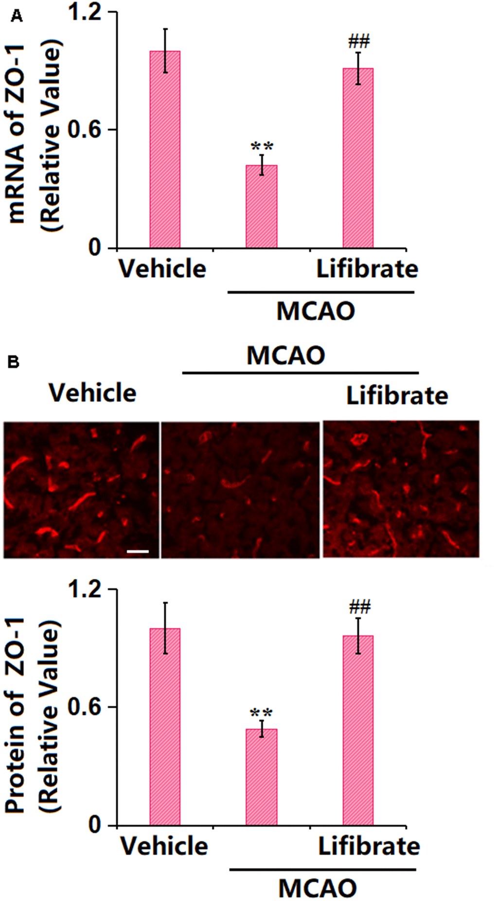 Lifibrate restored expression of the tight junction protein ZO-1 in a middle cerebral artery occlusion (MCAO) mice model. (A) mRNA of ZO-1; (B) Immunostaining of ZO-1. Scale bar, 100 μm (n=10, **, P