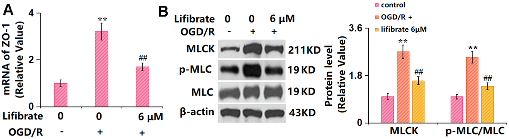 Lifibrate inhibited activation of the MLCK/p-MLC signaling against OGD/R. Cells were exposed to hypoxic conditions for 6 h, followed by exposure to reperfusion media for 24 h in the presence or absence of Lifibrate (6 μM). (A) mRNA of MLCK; (B) Protein levels of MLCK and p-MLC/MLC (n=6, **, P