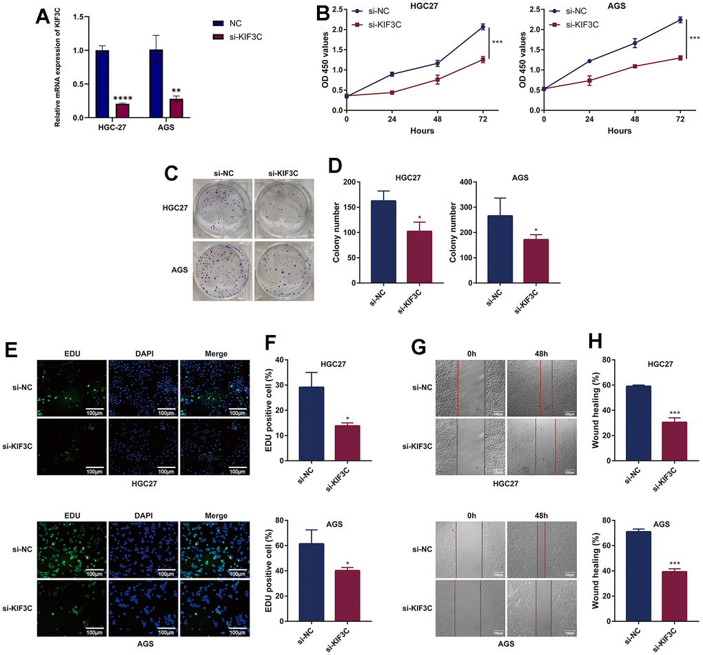 KIF3C knockdown suppresses the malignant phenotype of GC cells. (A) Knockdown efficiency of KIF3C in two Gastric cancer cell lines HGC-27 and AGS, including the si-NC and si-KIF3C groups. (B) CCK-8 assays were applied to detect the effect of KIF3C knockdown on the proliferation of HGC-27 and AGS cell lines. (C) Images of colony formation assay results after KIF3C knockdown in the HGC-27 and AGS cell lines. (D) Representative statistical analysis of the colony formation assay results. (E) DNA replication activity was assessed by an EdU-staining assay (green indicates the EdU-incorporated cells, blue indicates nuclei). GAPDH was used as an internal control. (F) Representative statistical analysis of the EdU assays results. (G) Wound-healing assays employed to detect the migration ability of KIF3C knockdown cells, including HGC-27 and AGS cells. (H) Representative statistical analysis of the wound-healing assays results. *p 