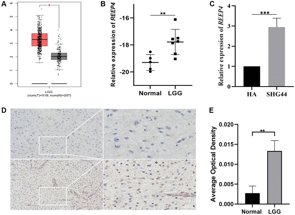 Differential expression level of receptor accessory protein 4 (REEP4) in LGG and normal brain tissue. (A) REEP4 is significantly upregulated in 518 lower-grade glioma (LGG) and 207 normal brain tissues based on GEPIA. *p B) Real-time quantitative polymerase chain reaction (RT-qPCR) of clinical samples showing elevated REEP4 expression in LGG tissues. **p C) RT-qPCR showing elevated REEP4 expression in LGG cell lines. ***p D, E) Immunohistochemistry shows elevated REEP4 expression in LGG tissue compared with than that in normal brain tissue. **p 