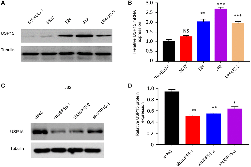 Screening of appropriate bladder cancer cell lines and effective shRNA interference fragment of USP15. (A, B) Western blot and qRT-PCR analysis of USP15 expression in human bladder normal cell line and bladder cancer cell lines. (C, D) USP15 protein expression in three types of shRNA.