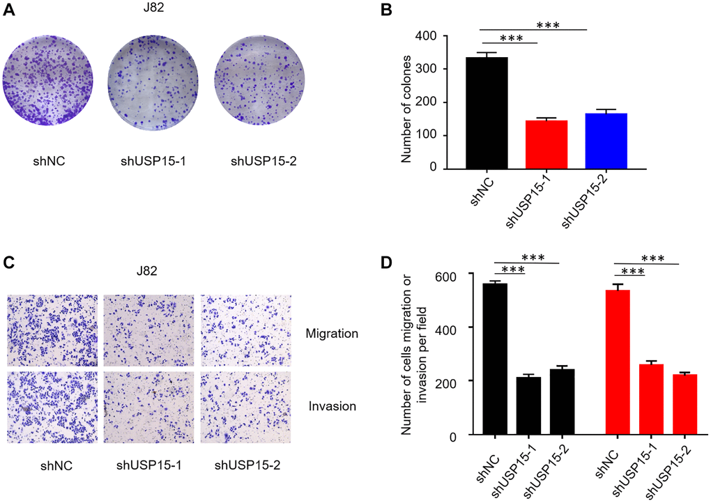 USP15 knockdown suppresses bladder cancer cell proliferation, migration, and invasion in vitro. (A, B) Proliferation capacity of bladder cancer cells J82 treated with sh-NC or sh-USP15 was detected by colony formation assays (***p C, D) Invasion and migration assays were conducted to evaluate the effect of USP15 knockdown on the metastatic ability of bladder cancer cells J82 (Magnification 200X). (*p **p ***p 
