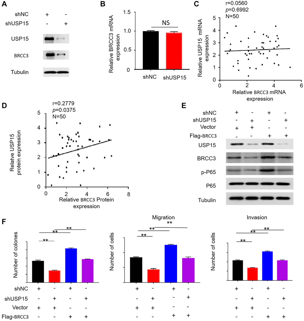 USP15 activates NF-κB signaling pathway by upregulating BRCC3 protein expression. (A) Western blotting was used to detect the expression of USP15 and BRCC3 proteins in J82 cells stably transfected with control shNC RNA or USP15 shRNA. (B) Relative mRNA expression of BRCC3 in normal and bladder cancer tissues. (C, D) Scatter plot of correlation between BRCC3 expression and USP15 expression. (E) Western blotting was used to detect the expression of USP15, BRCC3, P65 and p-P65 proteins in J82 cells stably transfected with USP15 shRNA or Flag-BRCC3 or both. (F) The upregulation of BRCC3 significantly saved the proliferation of J82-shUSP15 cells (**p **p 
