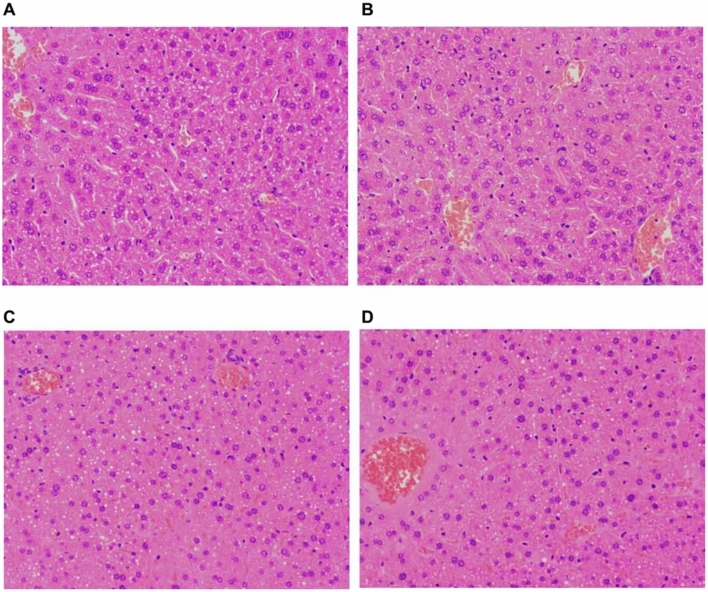 Histopathological alterations involving liver tissues. (A, B) Representative images of HE-stained liver tissues of the NC group; (C, D) Representative images of HE-stained liver tissues of the CIH group. NC group had normal hepatic architecture; CIH group showed some liver cells were slightly edematous with unclear borders. A few hepatocyte nuclei were slightly enlarged. Some cells were in sheets, and the demarcation of the hepatic cord was unclear. All images H&E with original magnification of 200X. NC, normal control; CIH, chronic intermittent hypoxia.