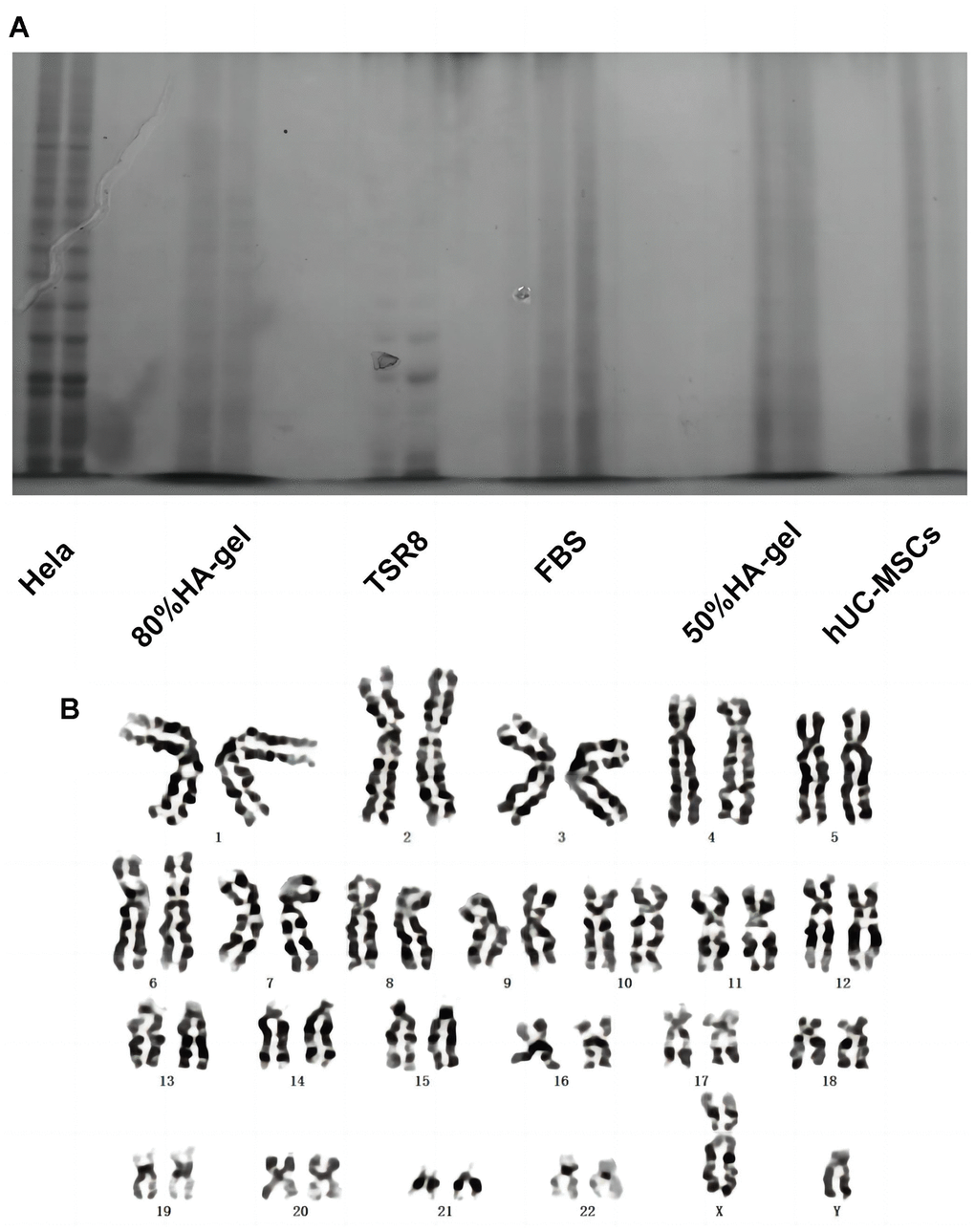 The effects of HA-gel on the genetic behavior of hUC-MSCs. (A) Telomerase activity detection; (B) Chromosomal karyotype analysis.
