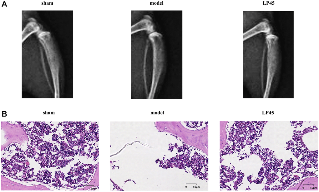 LP45 can inhibit the progression of osteoporosis. (A) Mice X-ray results; (B) HE staining results. **p 