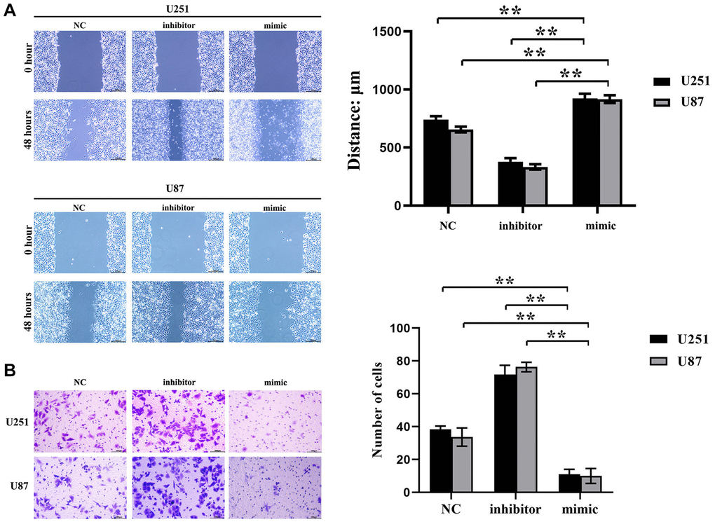 Inhibition effect of hsa-miR-134-5p on the migration and invasion ability of glioma cells. (A) The cell proliferation capacity of U251 and U87 cells was assessed by the scratch test following transfection with hsa-miR-134-5p mimics and inhibitors. (B) The cell proliferation capacity of U251 and U87 cells was assessed by Transwell following transfection with hsa-miR-134-5p mimics and inhibitors.