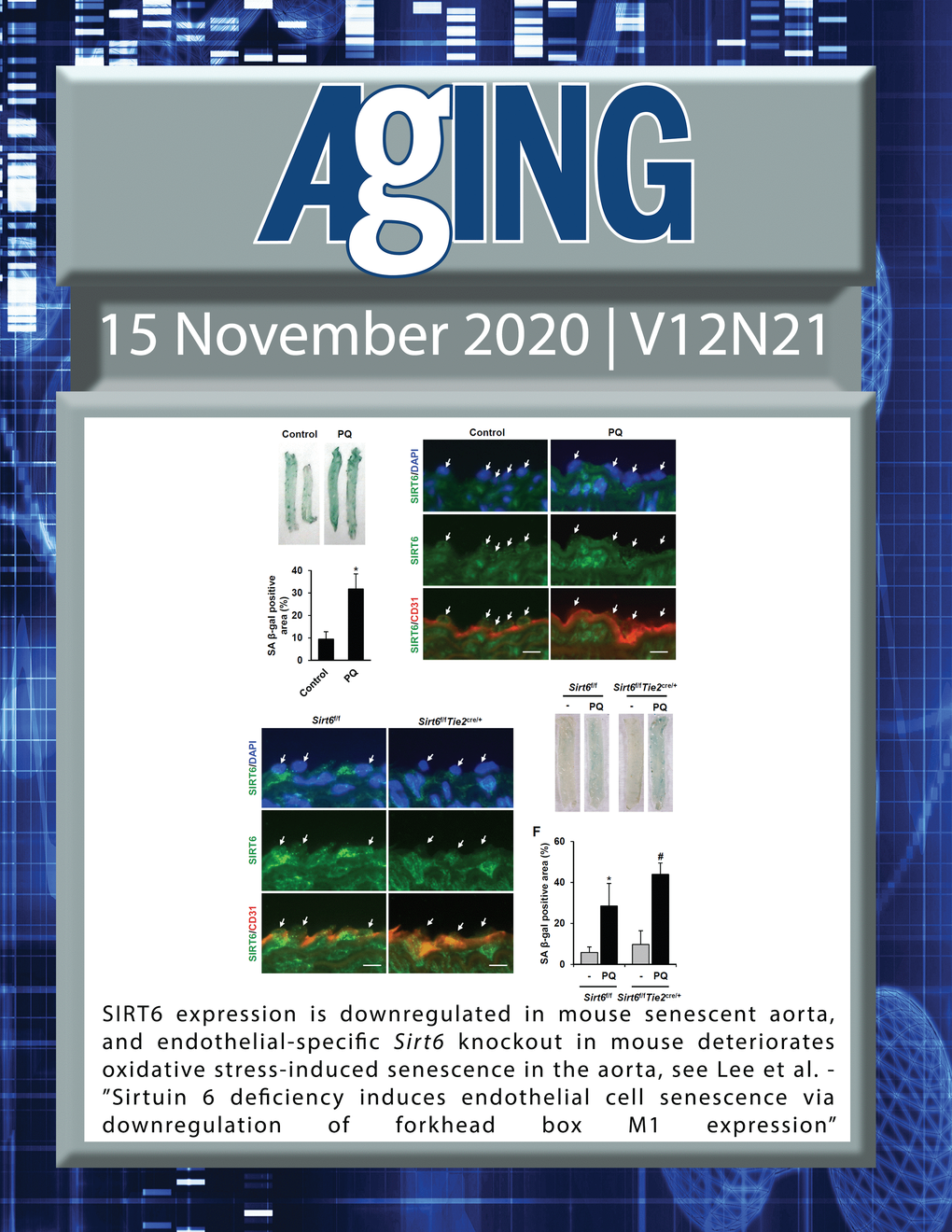 The cover features Figure 4 "SIRT6 expression is downregulated in mouse senescent aorta, and endothelial-specific Sirt6 knockout in mouse deteriorates oxidative stress-induced senescence in the aorta“ from Lee et al.